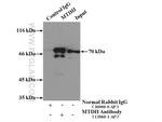 AEG-1/MTDH Antibody in Immunoprecipitation (IP)