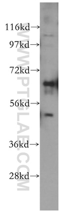 Frizzled 9 Antibody in Western Blot (WB)