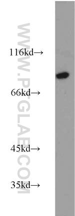 Calpain 7 Antibody in Western Blot (WB)