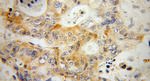 KBTBD2 Antibody in Immunohistochemistry (Paraffin) (IHC (P))