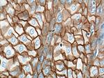 Desmocollin 2 Antibody in Immunohistochemistry (Paraffin) (IHC (P))