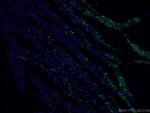 Desmocollin 2 Antibody in Immunohistochemistry (PFA fixed) (IHC (PFA))