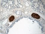 Aggrecan Antibody in Immunohistochemistry (Paraffin) (IHC (P))