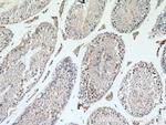 SIAH1 Antibody in Immunohistochemistry (Paraffin) (IHC (P))