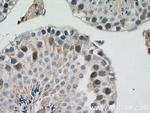 SIAH1 Antibody in Immunohistochemistry (Paraffin) (IHC (P))