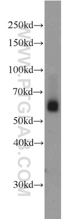 SIAH1 Antibody in Western Blot (WB)