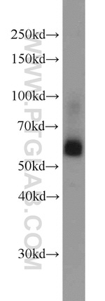 SIAH1 Antibody in Western Blot (WB)