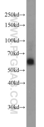 SIAH1 Antibody in Western Blot (WB)