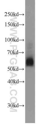 SIAH1 Antibody in Western Blot (WB)