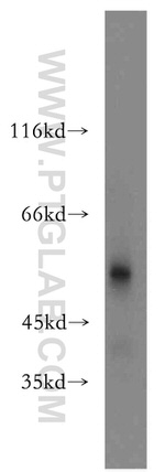 SIAH1 Antibody in Western Blot (WB)