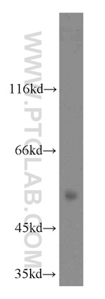 SIAH1 Antibody in Western Blot (WB)