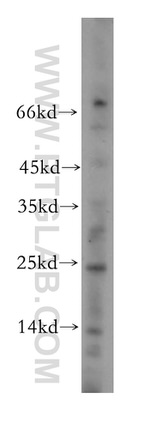 NDUFAF2 Antibody in Western Blot (WB)