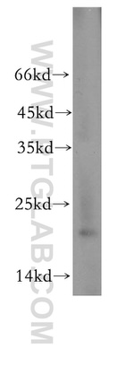 NDUFAF2 Antibody in Western Blot (WB)