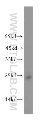 NDUFAF2 Antibody in Western Blot (WB)