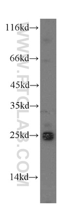 NDUFAF2 Antibody in Western Blot (WB)