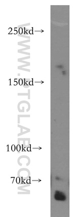 Synaptojanin 2 Antibody in Western Blot (WB)