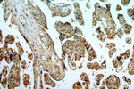 RABGAP1L Antibody in Immunohistochemistry (Paraffin) (IHC (P))