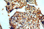 RABGAP1L Antibody in Immunohistochemistry (Paraffin) (IHC (P))