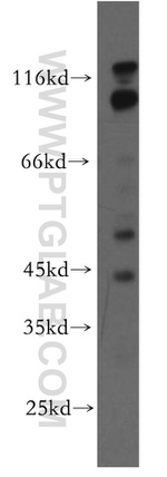 RABGAP1L Antibody in Western Blot (WB)