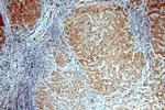 RABGAP1L Antibody in Immunohistochemistry (Paraffin) (IHC (P))