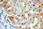 RABGAP1L Antibody in Immunohistochemistry (Paraffin) (IHC (P))