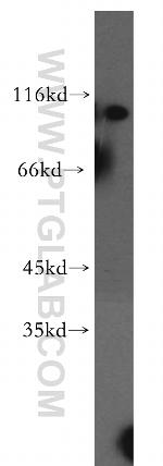 RABGAP1L Antibody in Western Blot (WB)