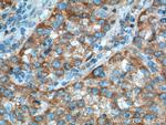 D2HGDH Antibody in Immunohistochemistry (Paraffin) (IHC (P))