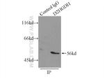 D2HGDH Antibody in Immunoprecipitation (IP)