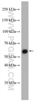 D2HGDH Antibody in Western Blot (WB)