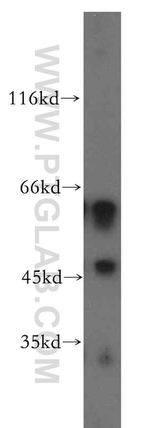 D2HGDH Antibody in Western Blot (WB)