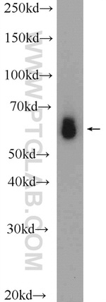 D2HGDH Antibody in Western Blot (WB)