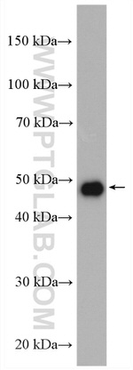 D2HGDH Antibody in Western Blot (WB)