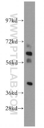 DHDH Antibody in Western Blot (WB)