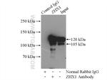 ZHX1 Antibody in Immunoprecipitation (IP)