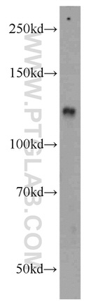 ZHX1 Antibody in Western Blot (WB)