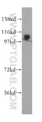 ZHX1 Antibody in Western Blot (WB)