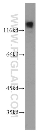 ZHX1 Antibody in Western Blot (WB)