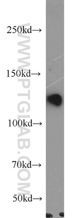 ZHX1 Antibody in Western Blot (WB)