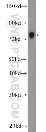 NR1D2 Antibody in Western Blot (WB)