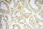 AKAP3 Antibody in Immunohistochemistry (Paraffin) (IHC (P))