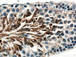 AKAP3 Antibody in Immunohistochemistry (Paraffin) (IHC (P))