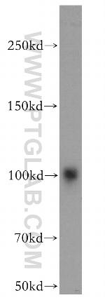 AKAP3 Antibody in Western Blot (WB)