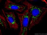 SNN Antibody in Immunocytochemistry (ICC/IF)