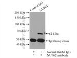 NUP62 Antibody in Immunoprecipitation (IP)