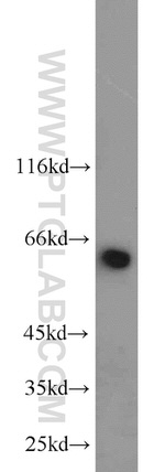 NUP62 Antibody in Western Blot (WB)