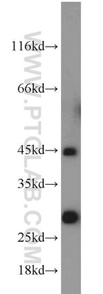 HORMAD1 Antibody in Western Blot (WB)