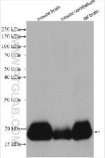 VILIP-1 Antibody in Western Blot (WB)