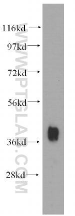 NKX2-5 Antibody in Western Blot (WB)