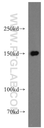 DHX29 Antibody in Western Blot (WB)