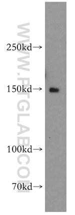 DHX29 Antibody in Western Blot (WB)